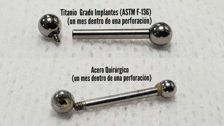 Diferencias clave: acero quirúrgico vs titanio para implantes, ¿cuál es mejor?